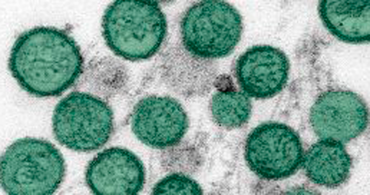 virus